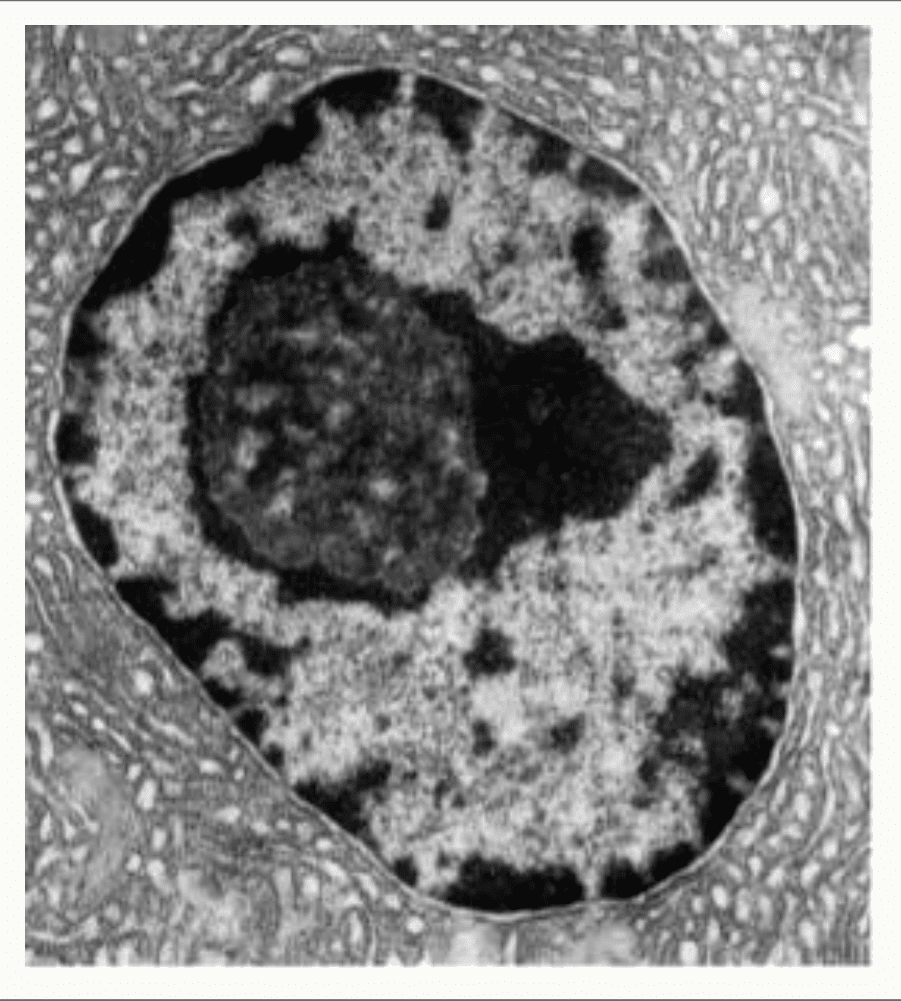 Noyau interphasique observé au microscope électronique