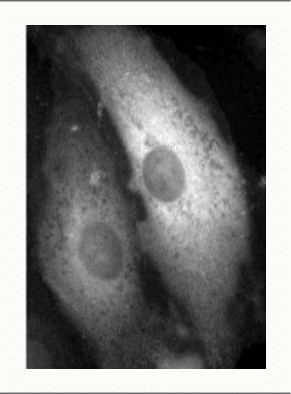 Noyaux de forme régulière observés en microscopie de fluorescence
