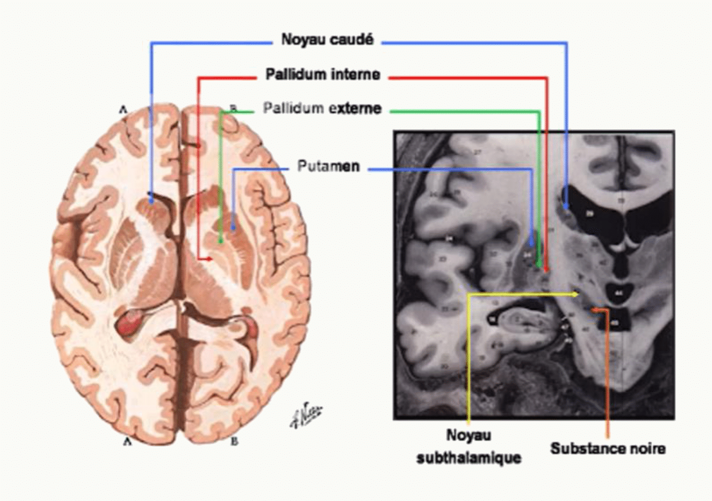 Noyaux gris centraux : noyau caudé, putamen, pallidum, noyau subthalamique et substance noire