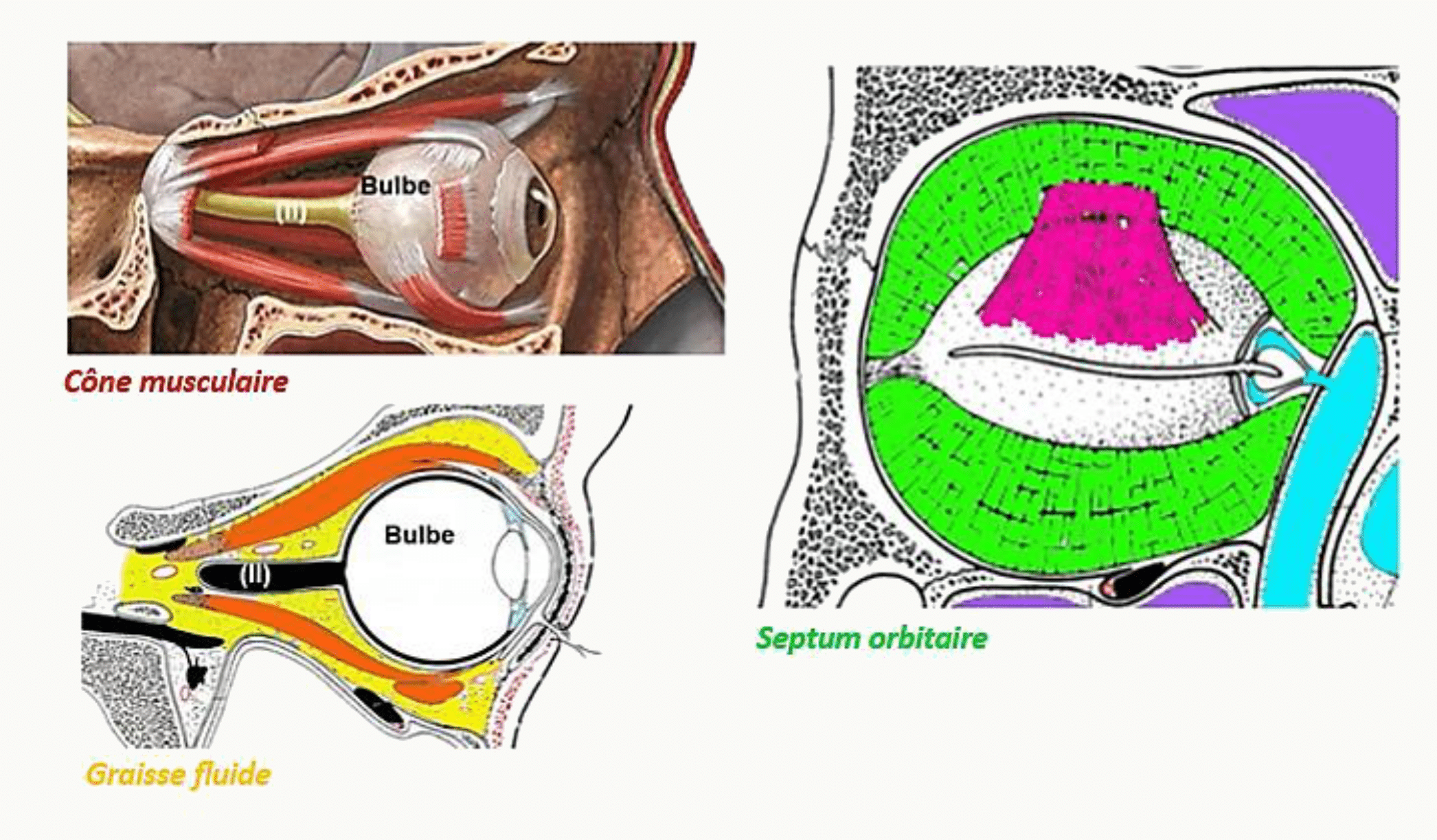 Orbite avec son cône musculaire, la graisse orbitaire et le septum orbitaire