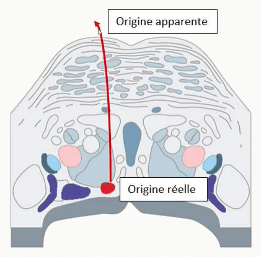 Origine apparente et origine réelle d'un nerf spinal sur une coupe de moelle