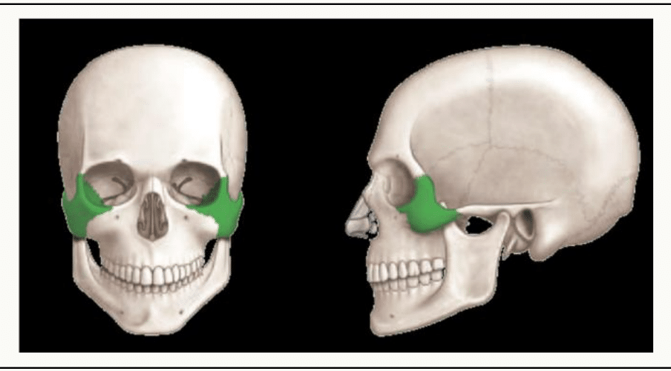 Os lacrymal replacé sur le crâne