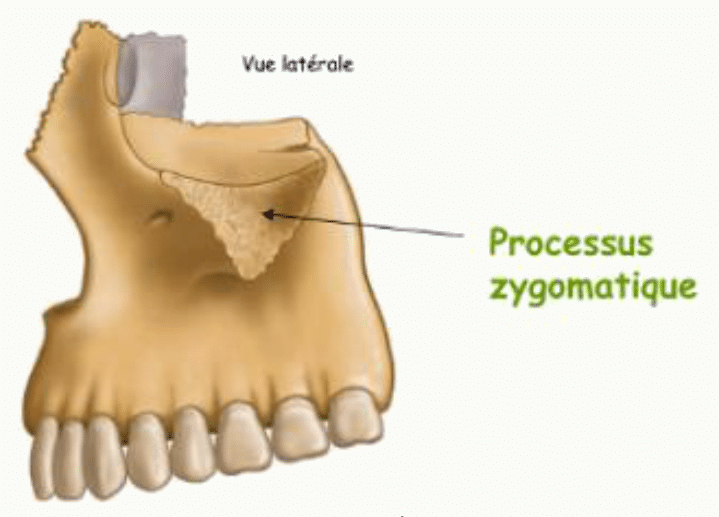 Os maxillaire en vue latérale avec son processus zygomatique