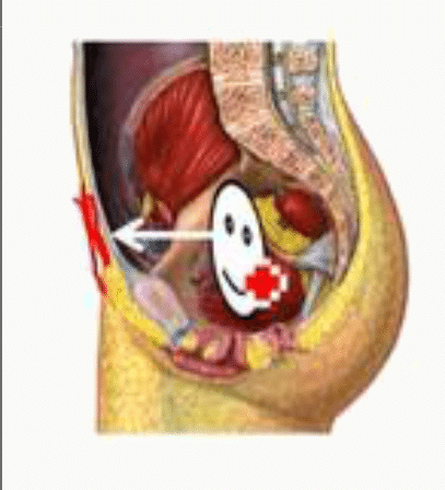 Paroi antérieure du pelvis en coupe sagittale