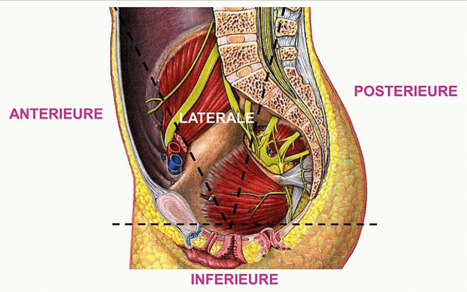 Les quatre parois du pelvis repérées sur une coupe sagittale