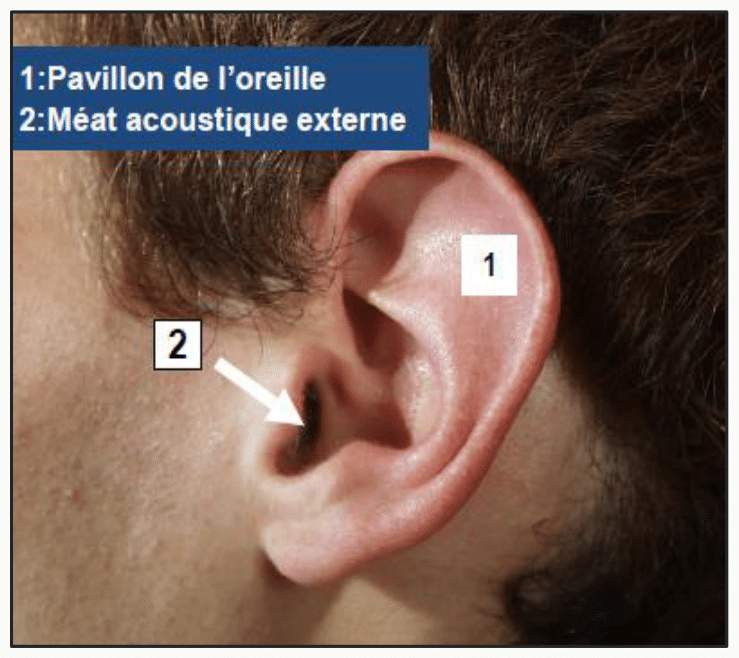 Pavillon de l'oreille et méat acoustique externe