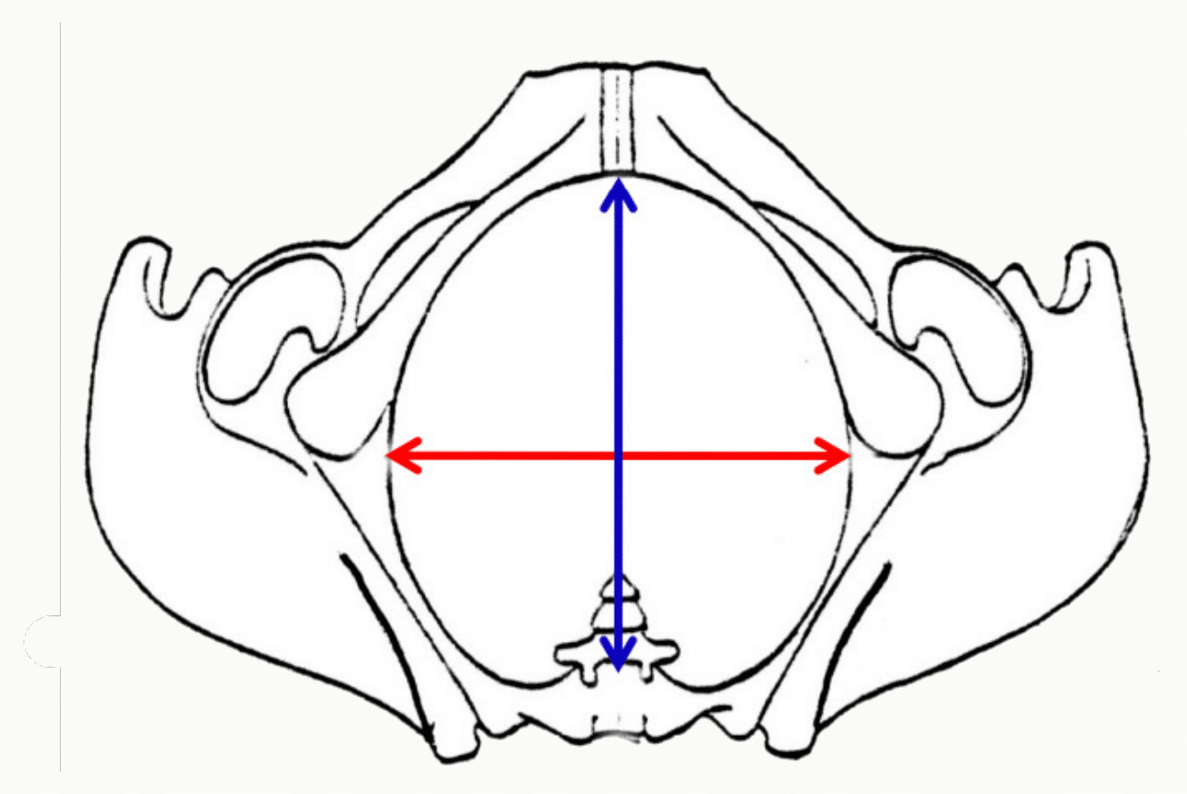 Pelvimétrie : mesure des diamètres transverse et antéro-postérieur du bassin