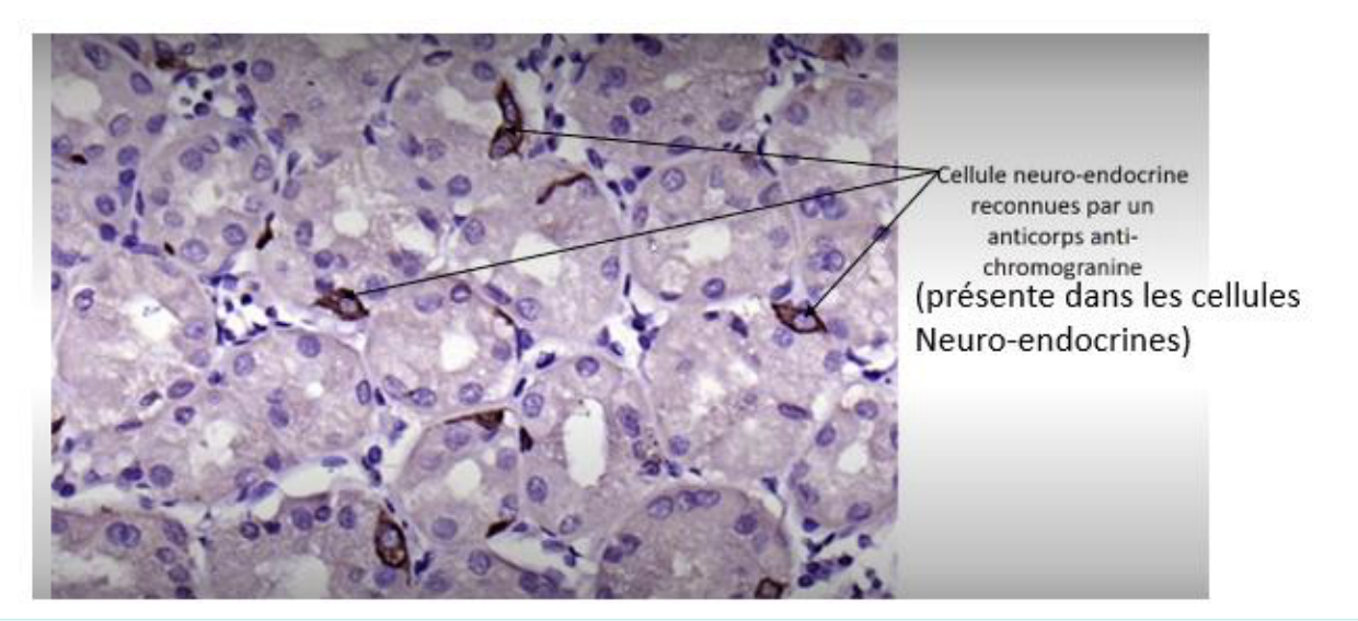 Cellules neuro-endocrines révélées au microscope optique