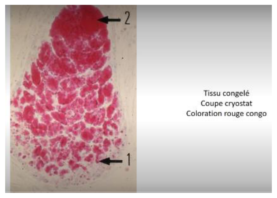 Coupe de tissu congelé au cryostat colorée au rouge Congo
