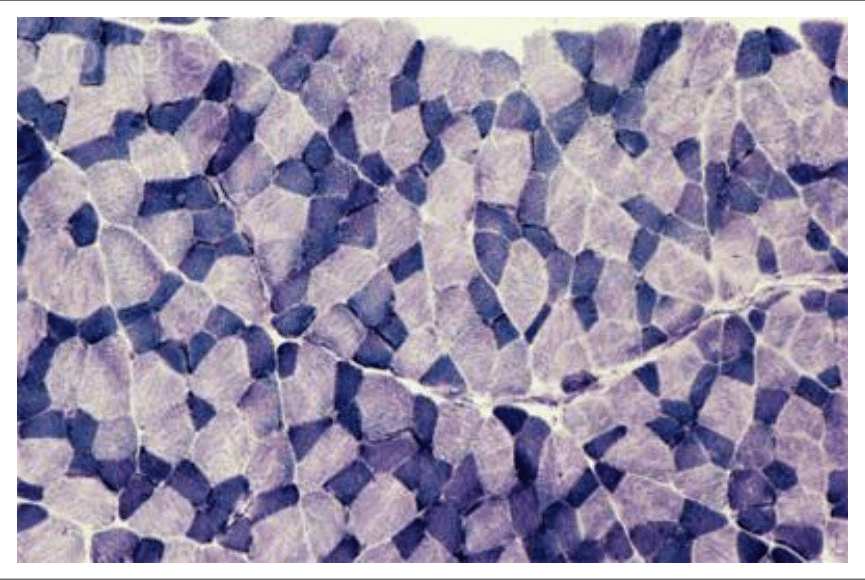 Types de fibres musculaires distingués sur une coupe transversale de muscle