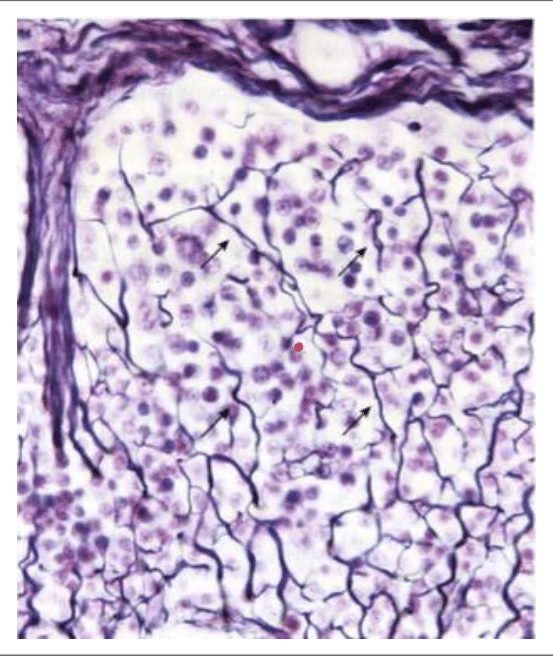Réseau de fibres élastiques révélé à l'orcéine au microscope optique