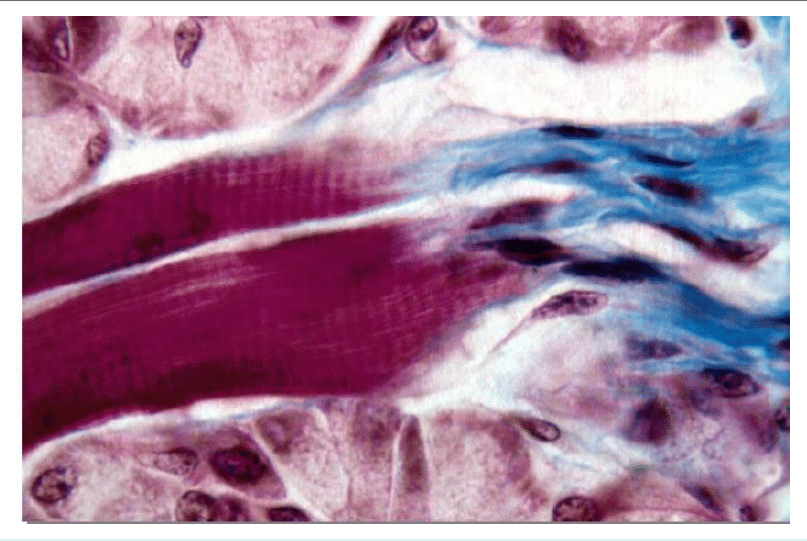 Jonction entre fibres musculaires et tendon au microscope optique