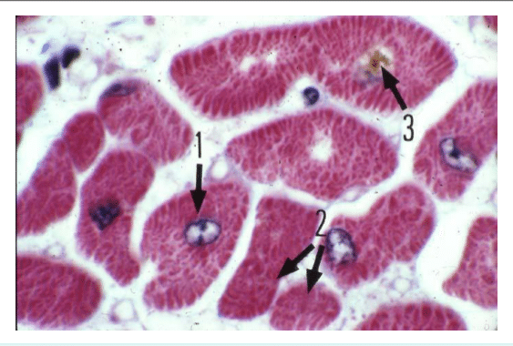 Cardiomyocytes striés à noyau central au microscope optique