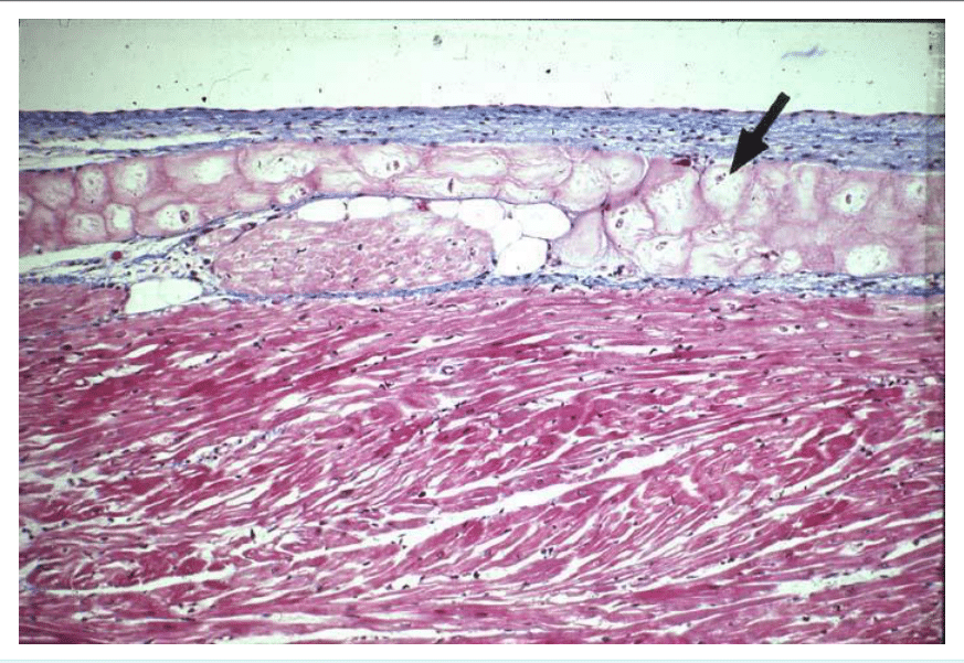 Couches longitudinale et circulaire de muscle lisse dans la paroi intestinale