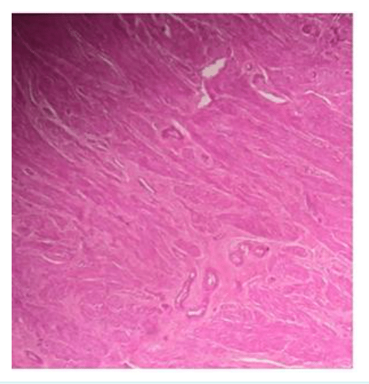 Faisceaux de cellules fusiformes de muscle lisse au microscope optique