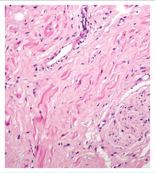 Muscle lisse formé de cellules fusiformes à noyau central au microscope optique
