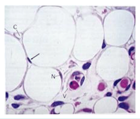 Tissu adipeux blanc constitué d'adipocytes à grande vacuole lipidique