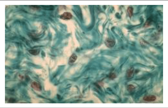 Tissu conjonctif avec ses fibres de collagène au microscope optique (trichrome)