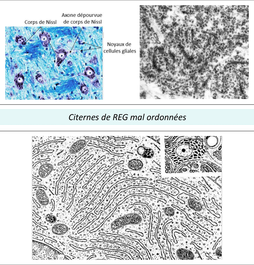 Corps de Nissl formés de réticulum endoplasmique granuleux, en coloration et en MET