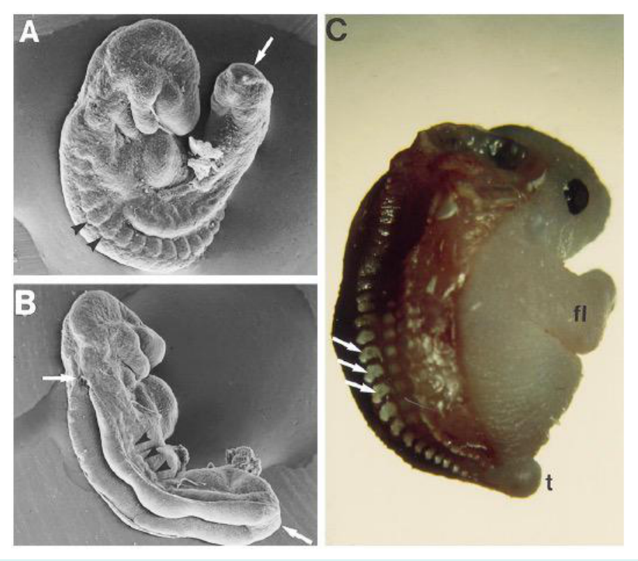 Tube neural ouvert du mutant Loop-Tail (Vangl) avec plancher élargi et bourrelets non fusionnés, comparé à une souris normale