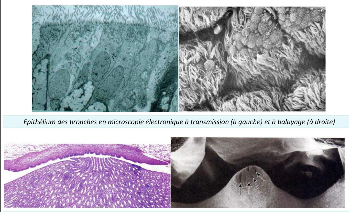 Épithélium des bronches observé en microscopie électronique à transmission et à balayage