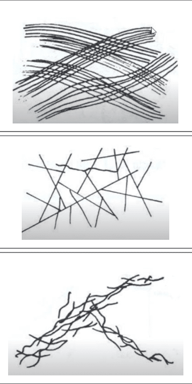 Fibres de collagène et de réticuline au microscope électronique à balayage