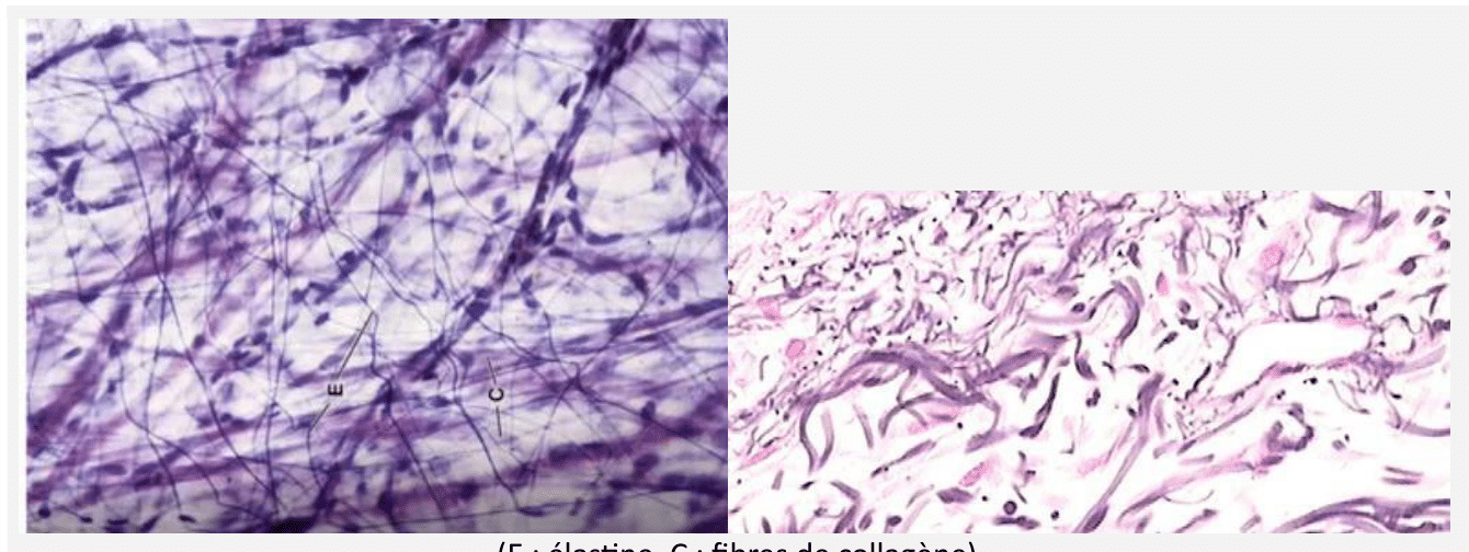 Fibres élastiques d'un tissu conjonctif au microscope optique