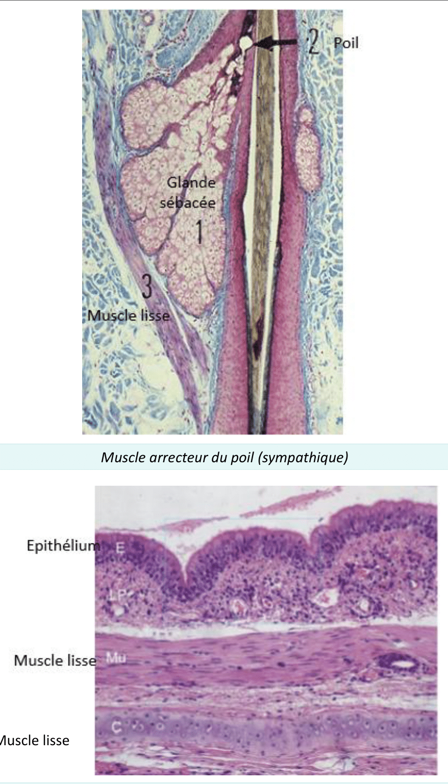 Muscle arrecteur du poil, faisceau de muscle lisse rattaché au follicule pileux