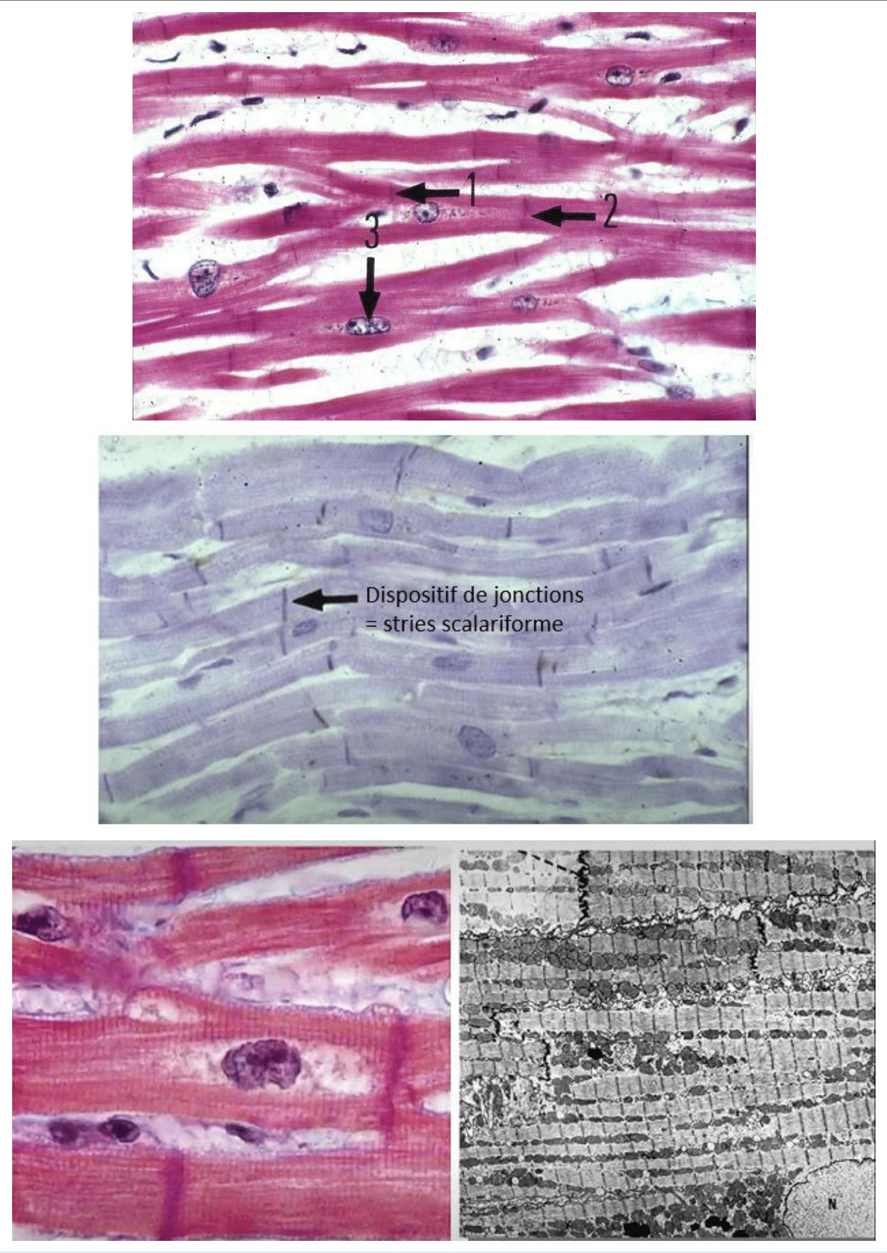 Muscle cardiaque et ses disques intercalaires reliant les cardiomyocytes