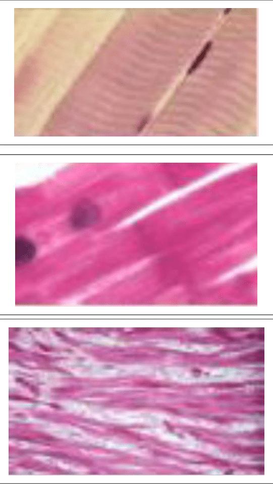 Muscle strié squelettique et ses striations transversales au microscope optique