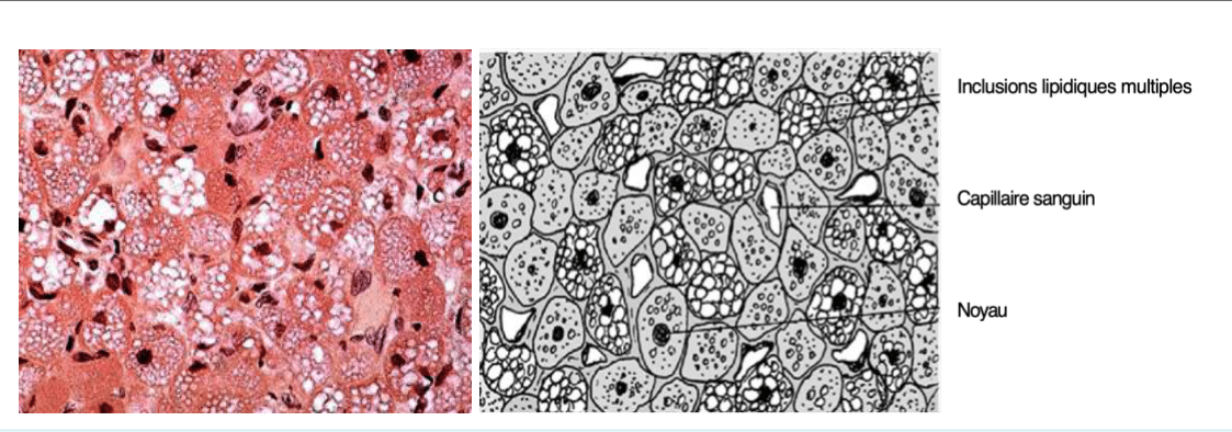 Tissu adipeux aux inclusions lipidiques multiples et capillaires sanguins