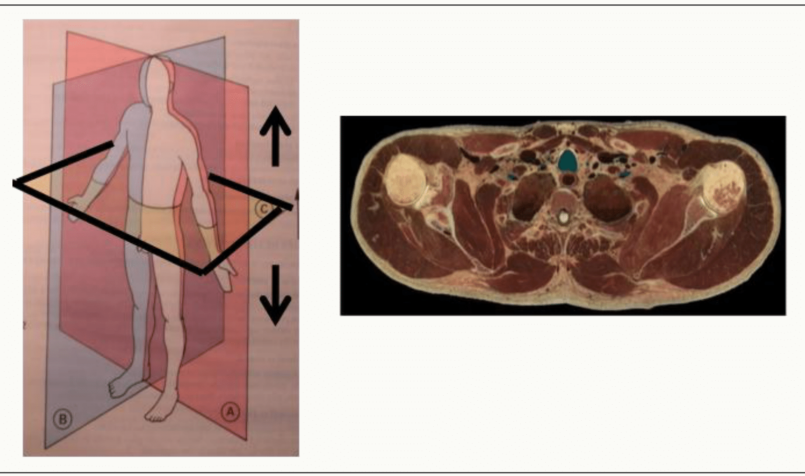 Plan axial et coupe transversale du thorax en imagerie médicale