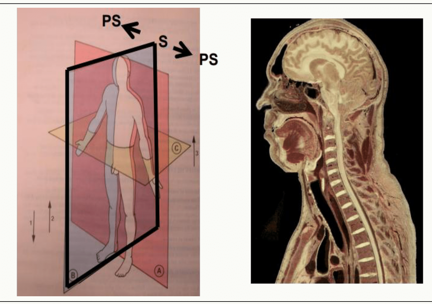 Plan sagittal et coupe sagittale de la tête en imagerie médicale