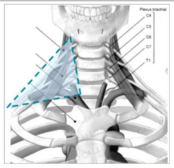 Racines du plexus brachial et défilés qu'elles traversent au niveau du cou