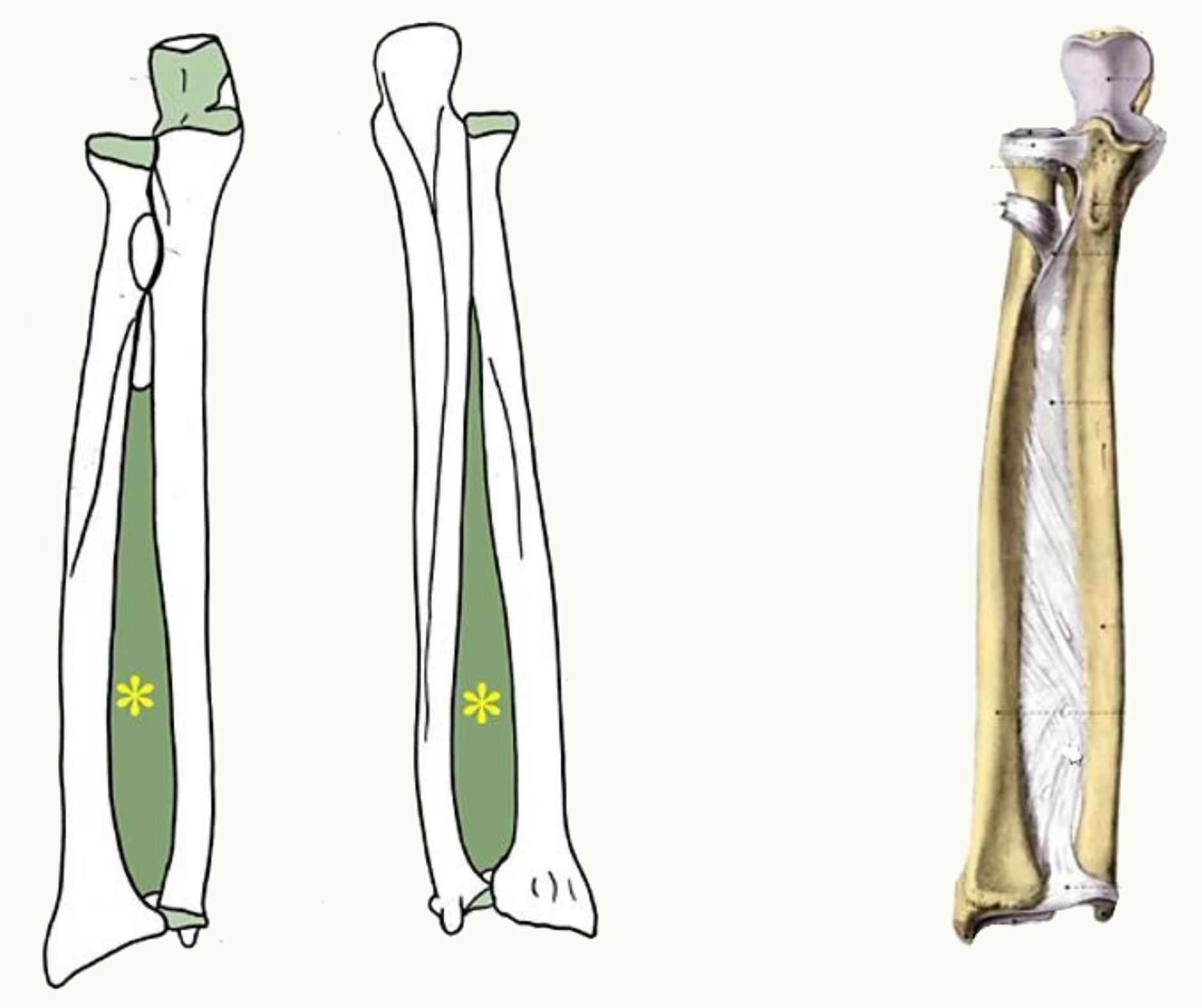 Radius et ulna réunis par la membrane interosseuse, en vue d'ensemble