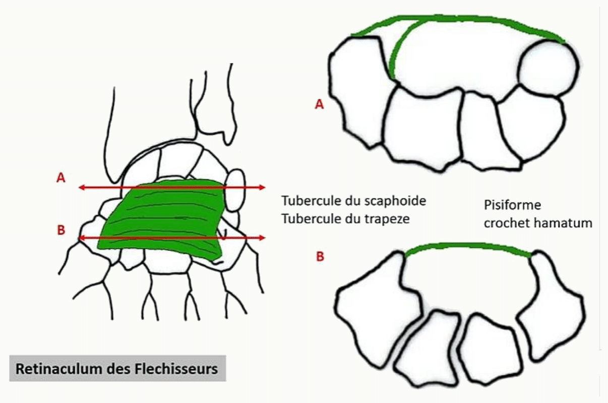 Rétinaculum des fléchisseurs tendu entre les tubercules du scaphoïde, du trapèze, le pisiforme et l'hamulus de l'hamatum