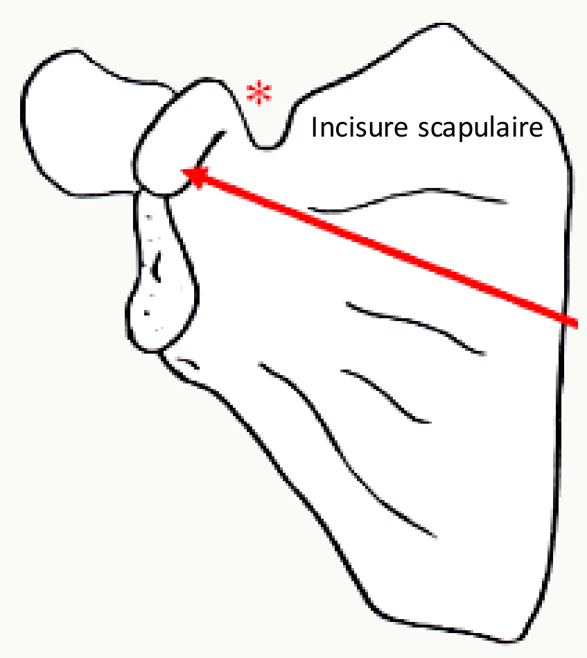 Face antérieure de la scapula avec la fosse sub-scapulaire et l'incisure scapulaire