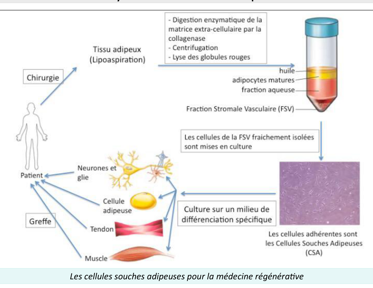 Cellules souches adipeuses en médecine