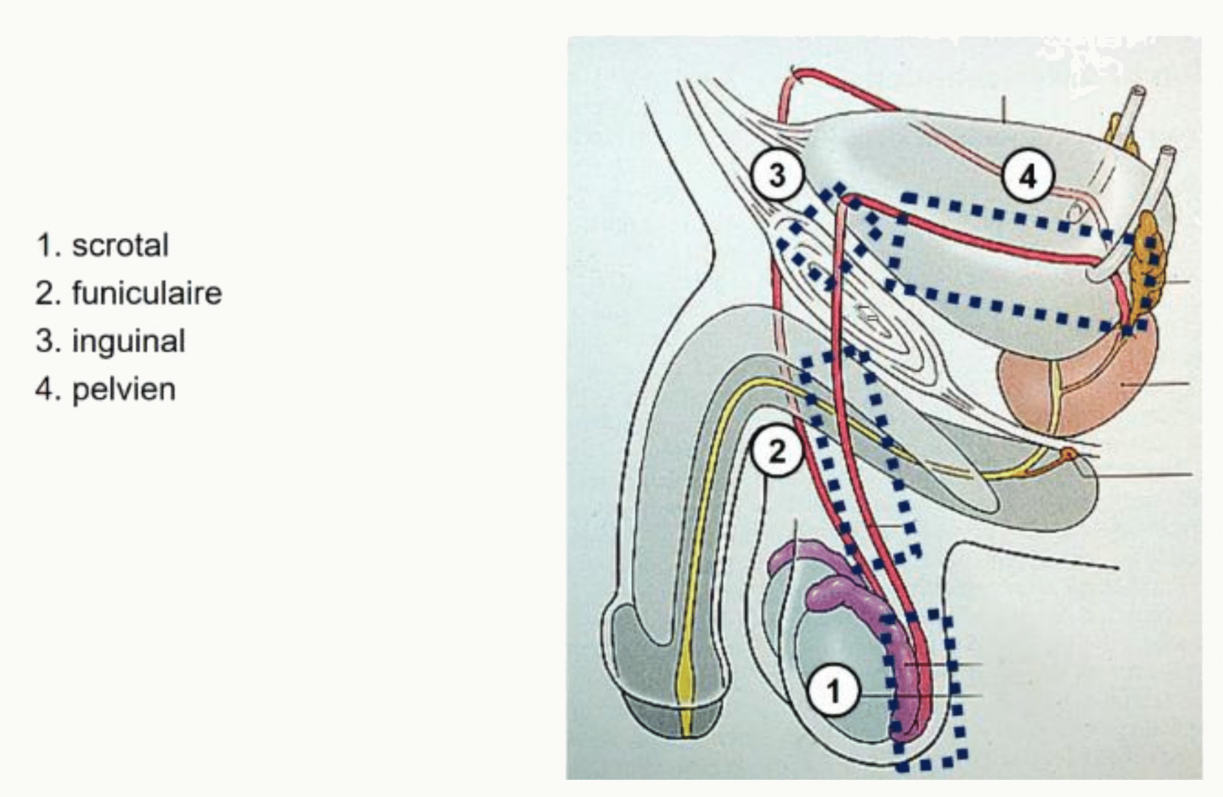 Les quatre segments du conduit déférent : scrotal, funiculaire, inguinal et pelvien