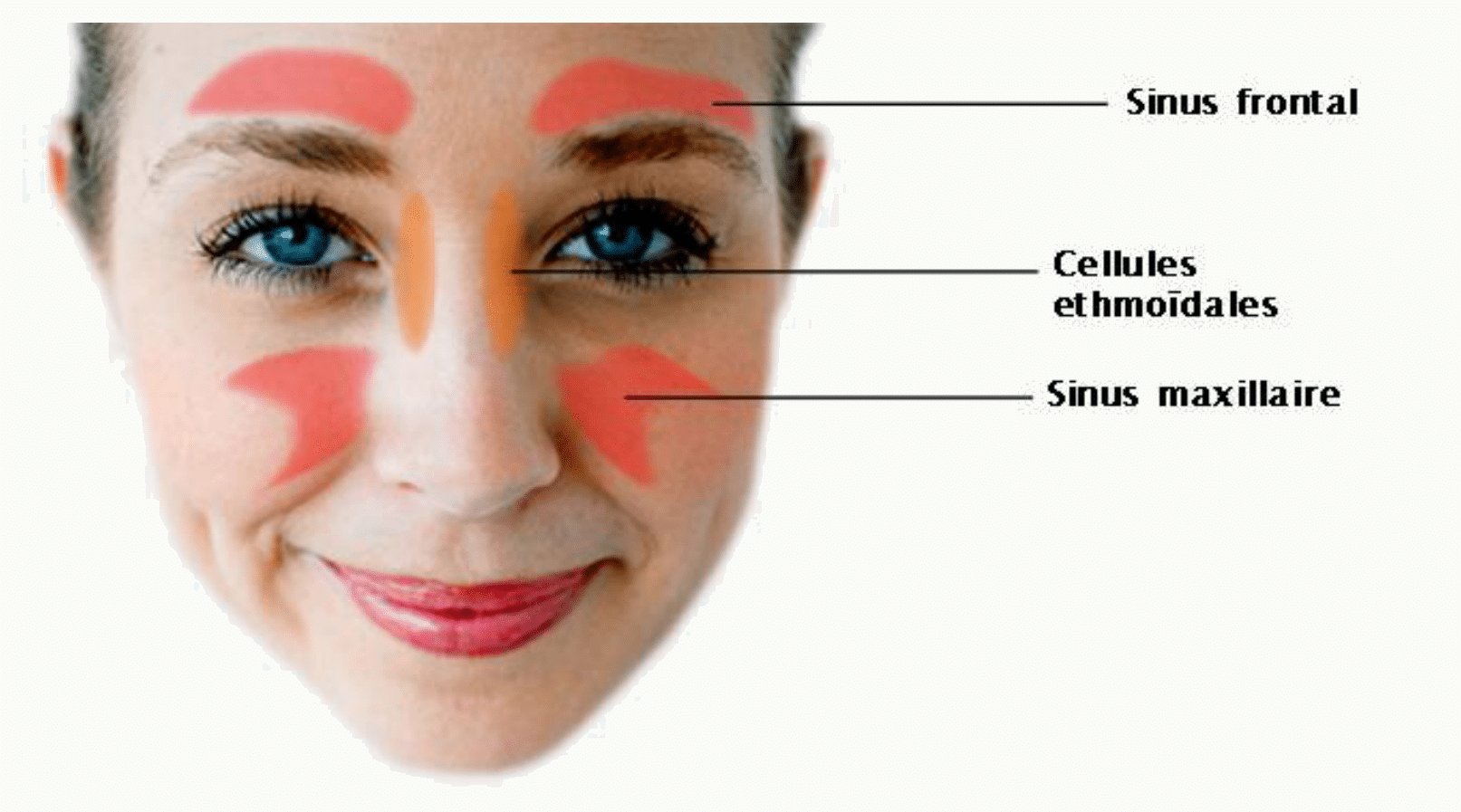Projection des sinus frontal, ethmoïdal et maxillaire sur le visage