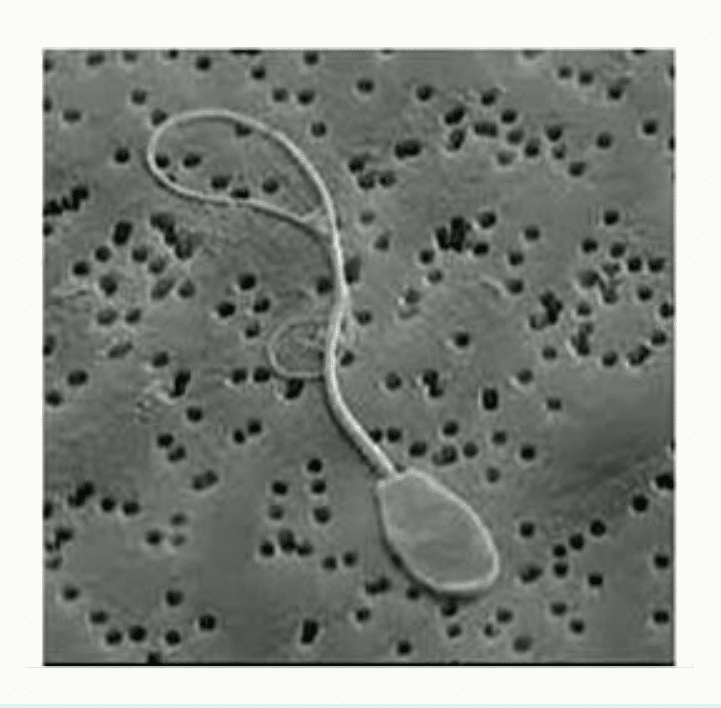 Spermatozoïde et son flagelle en microscopie électronique à balayage