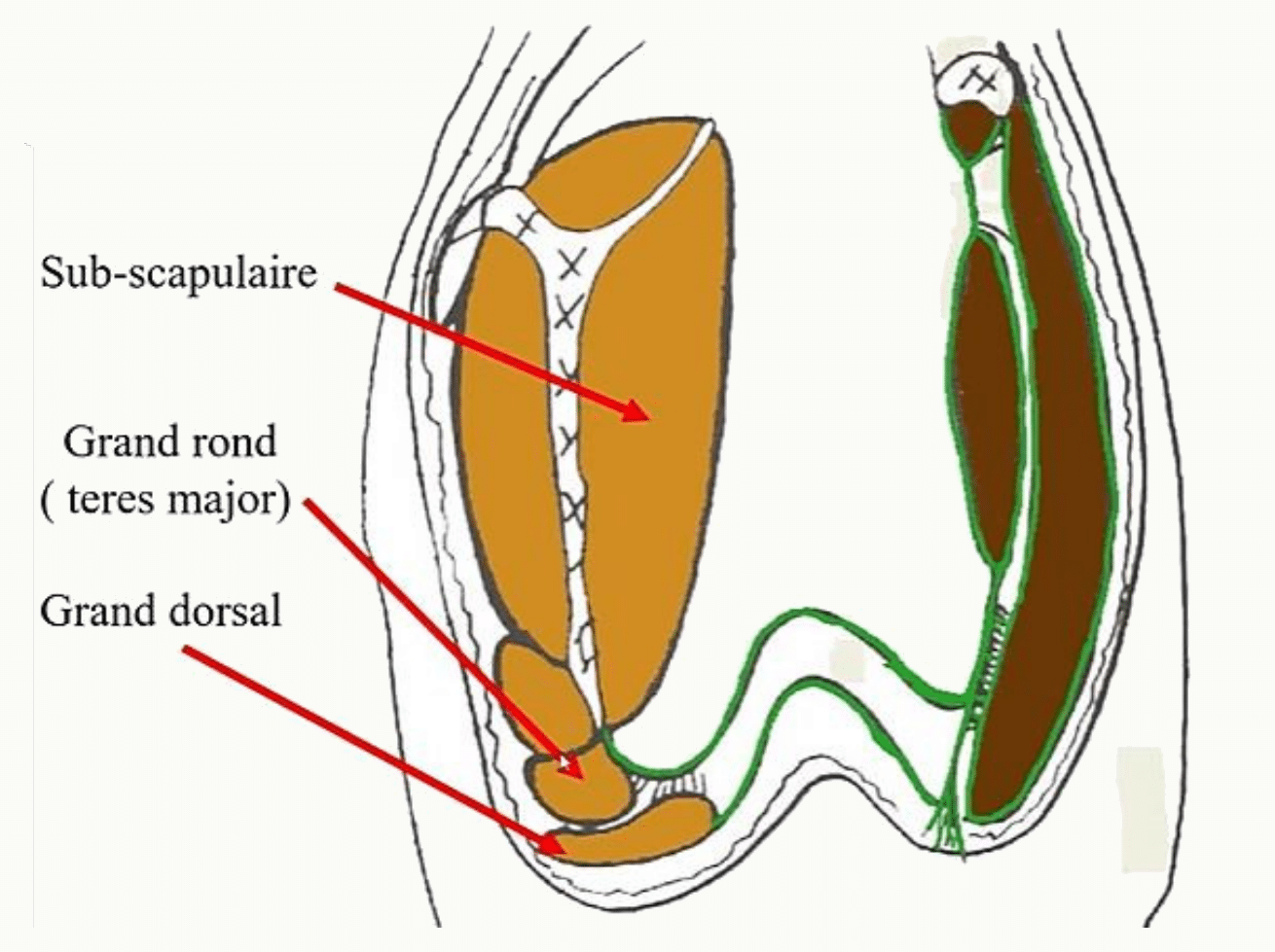 Sub-scapulaire, grand rond et grand dorsal et leurs insertions humérales