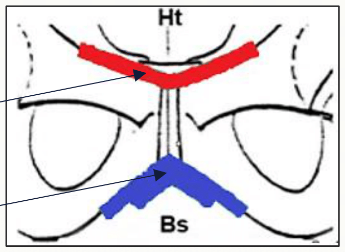 Symphyse pubienne en coupe frontale avec son disque fibro-cartilagineux