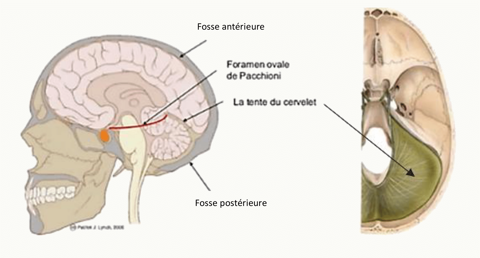 Tronc cérébral en vue sagittale dans la fosse postérieure