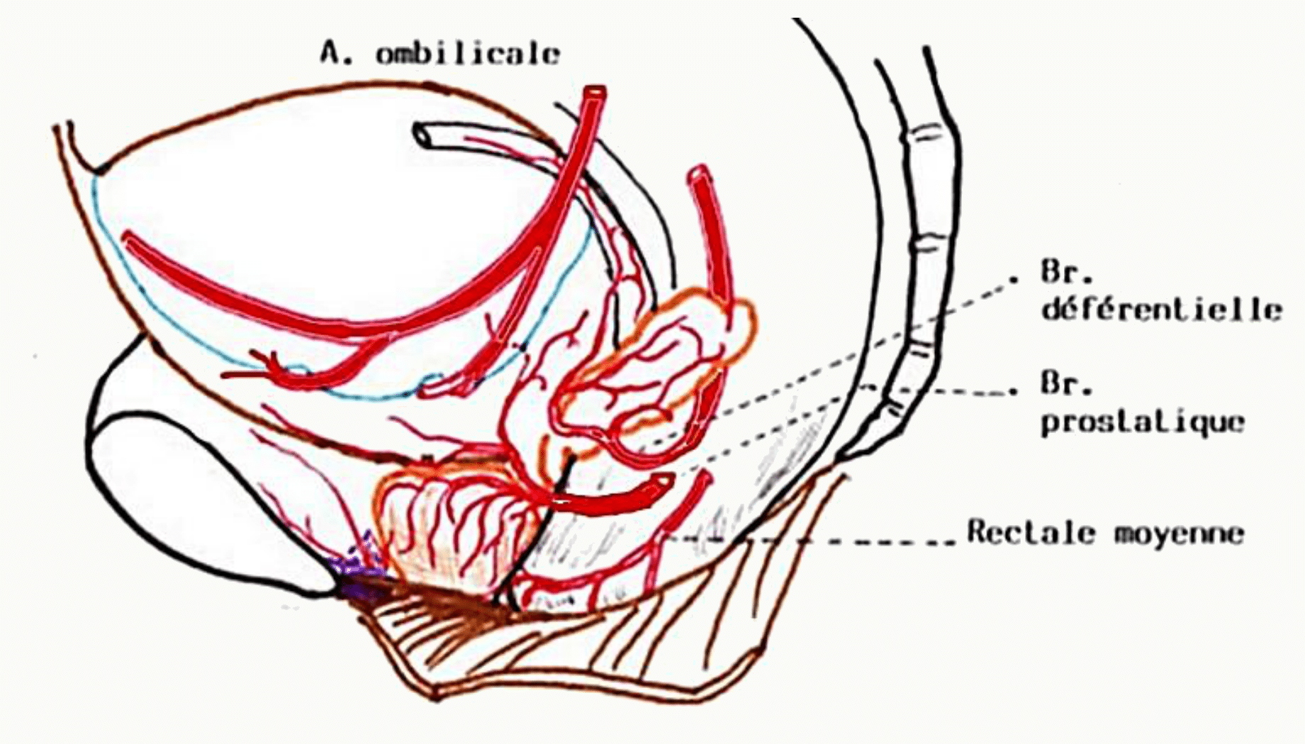 Vascularisation artérielle de la prostate par les branches vésicales et prostatiques