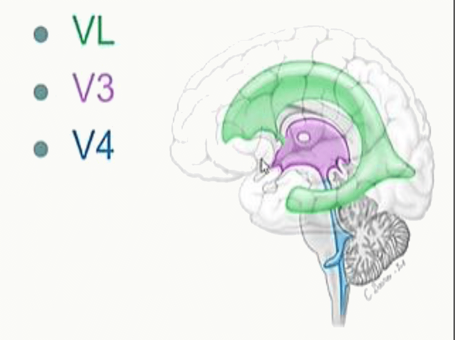 Système ventriculaire : ventricules latéraux, troisième et quatrième ventricule