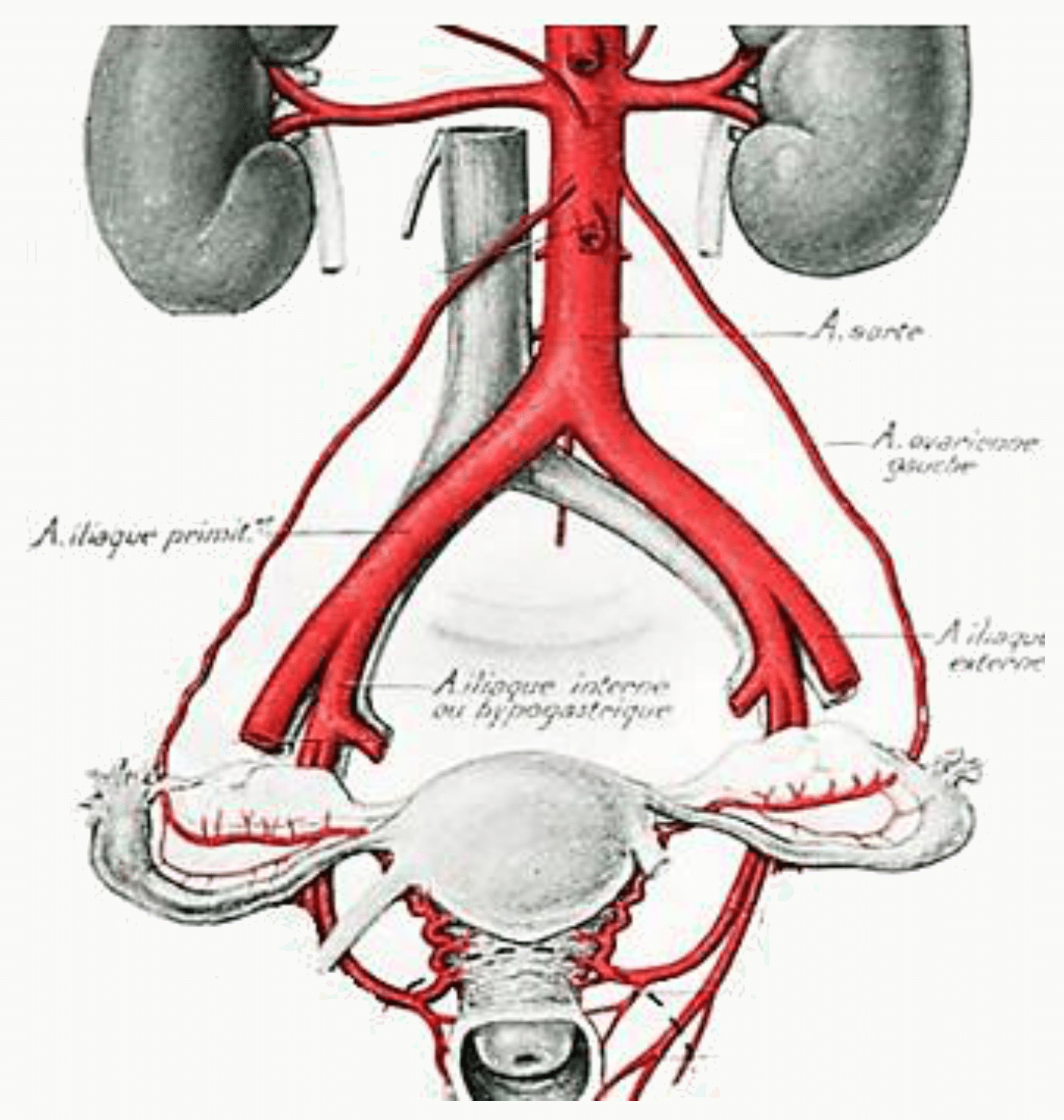 Artères ovariques nées de l'aorte et artères utérines nées des iliaques internes