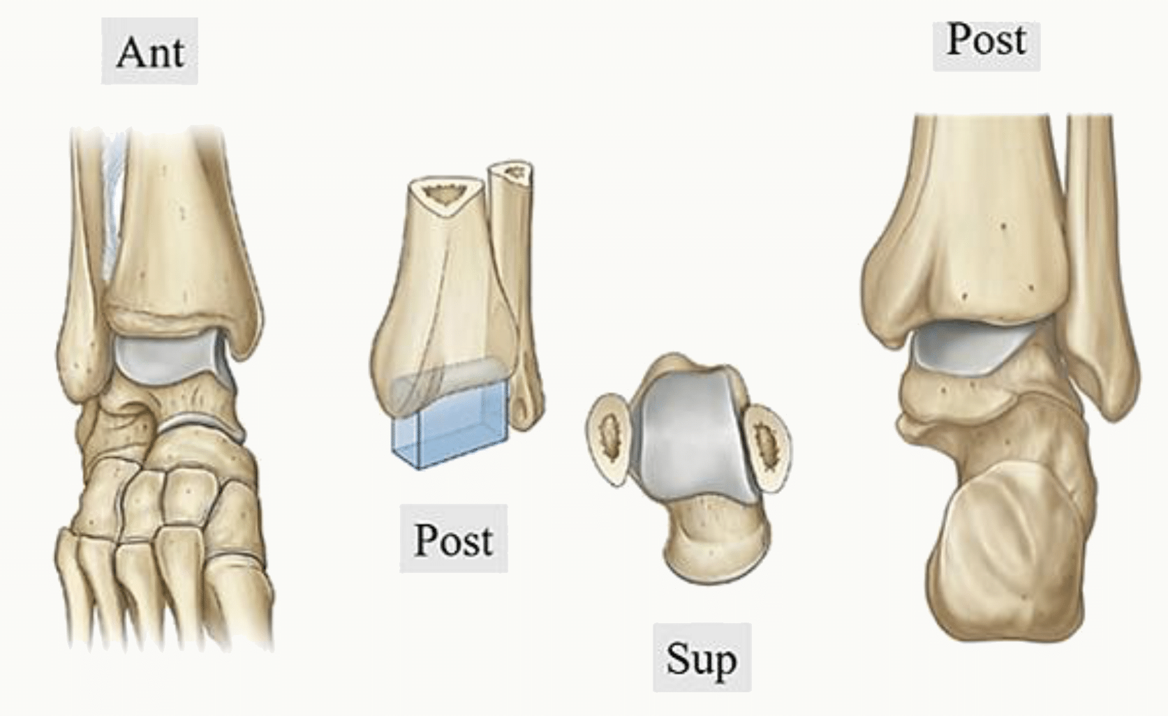 Articulation talo-crurale : pince bi-malléolaire du tibia et de la fibula et trochlée du talus