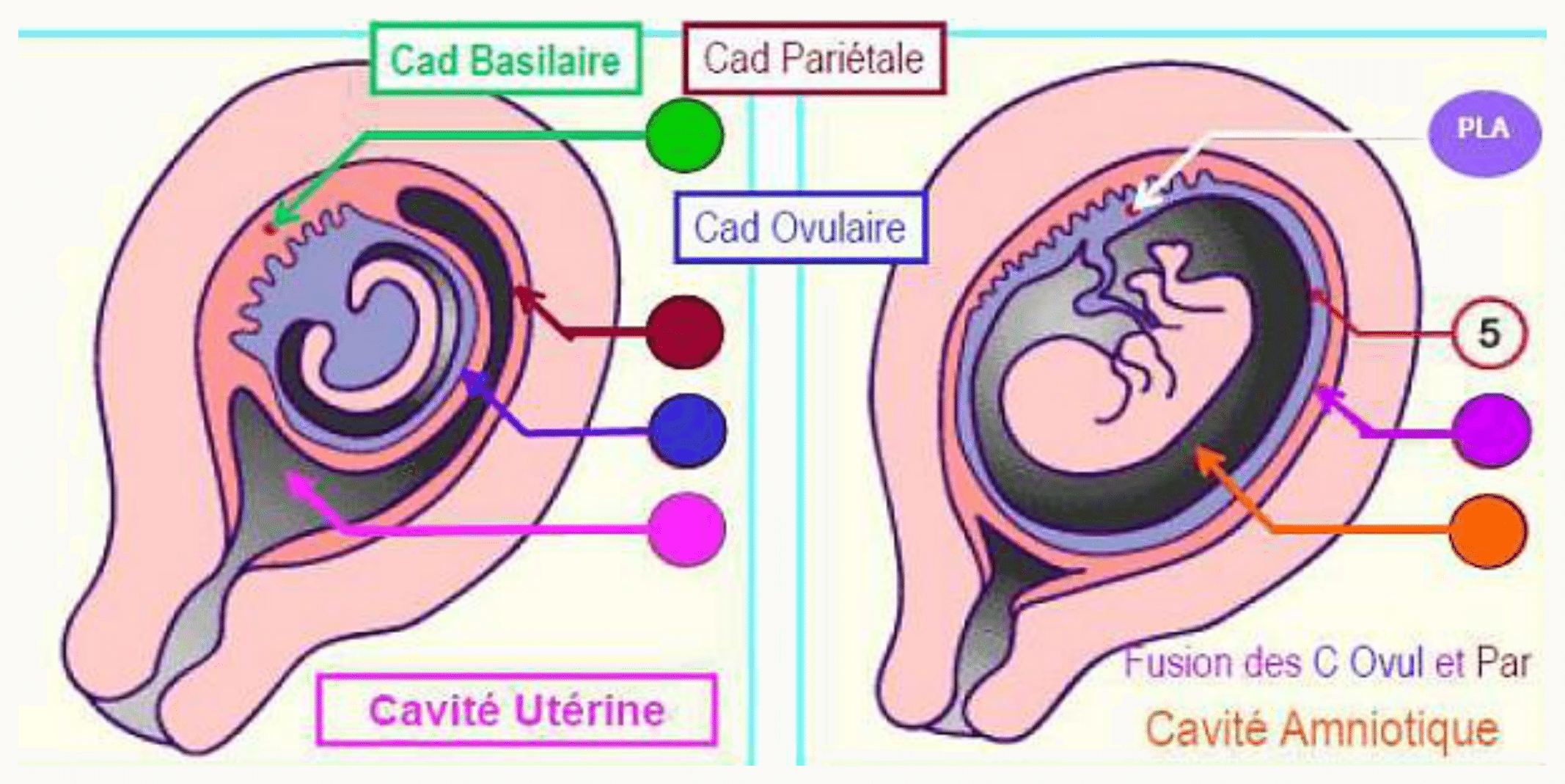 Schéma des caduques et de la cavité utérine résiduelle oblitérée par la fusion des caduques ovulaire et pariétale