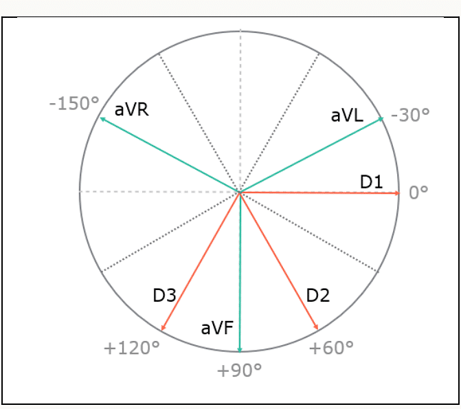 Cercle de Bailey avec les 6 dérivations frontales D1, D2, D3, aVR, aVL, aVF réparties tous les 30°.